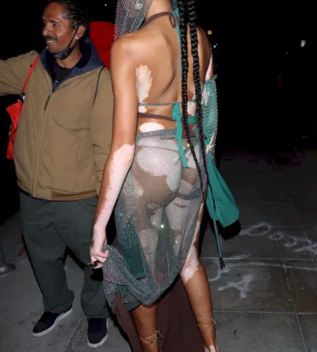 Image 1739081 from Winnie Harlow