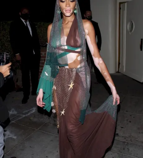 Image 1739001 from Winnie Harlow
