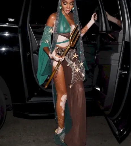 Image 1739282 from Winnie Harlow