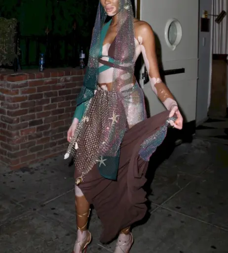 Image 1738874 from Winnie Harlow
