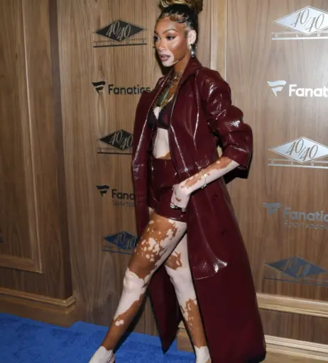Image 1738554 from Winnie Harlow