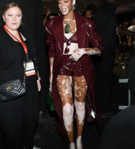Image 1738579 from Winnie Harlow