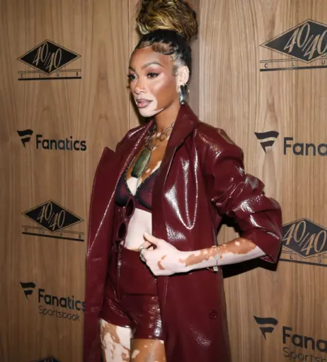 Image 1738453 from Winnie Harlow