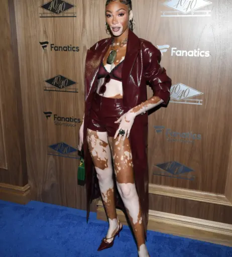 Image 1738475 from Winnie Harlow