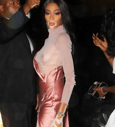 Image 1738730 from Winnie Harlow