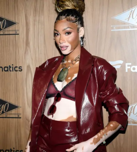 Image 1738650 from Winnie Harlow