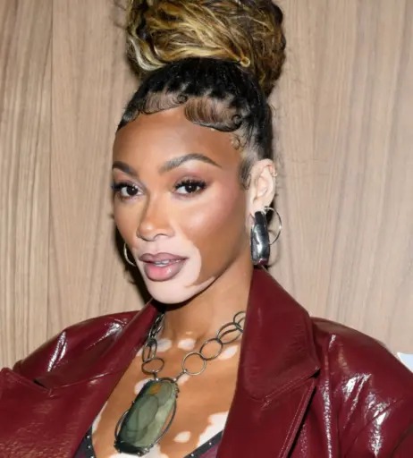 Image 1738617 from Winnie Harlow