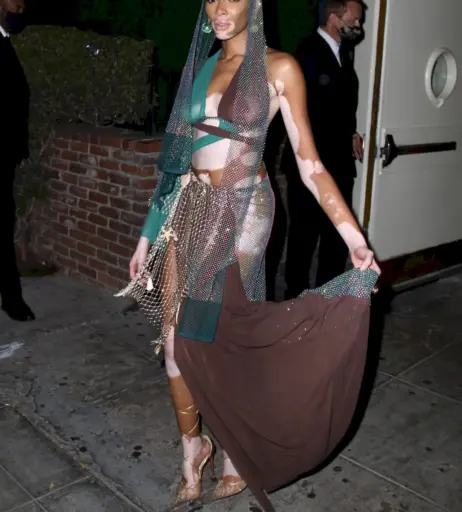 Image 1738982 from Winnie Harlow