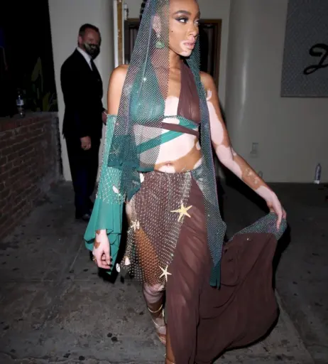 Image 1738957 from Winnie Harlow