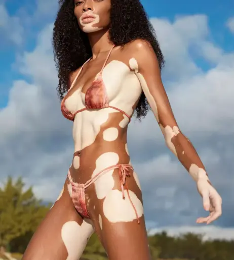 Image 1729891 from Winnie Harlow