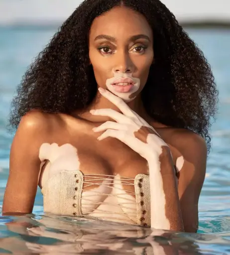 Image 1729827 from Winnie Harlow