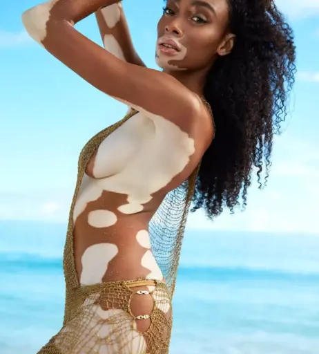 Image 1729595 from Winnie Harlow