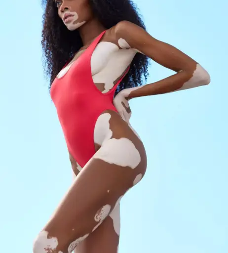 Image 1729547 from Winnie Harlow