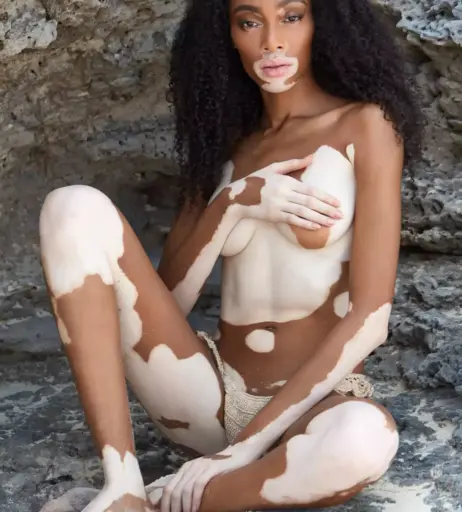 Image 1729454 from Winnie Harlow