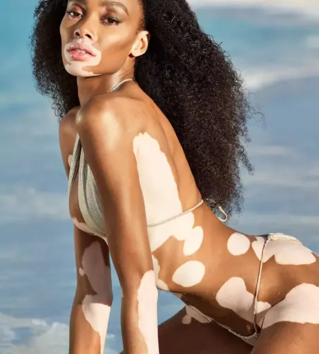 Image 1729699 from Winnie Harlow