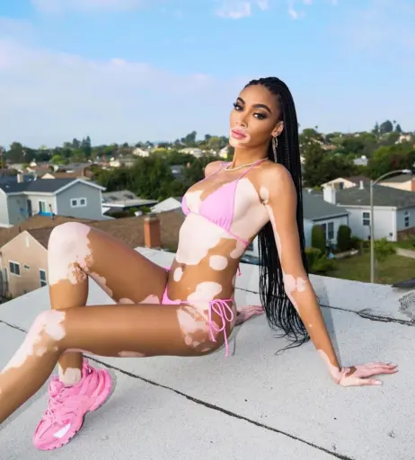 Image 1728400 from Winnie Harlow