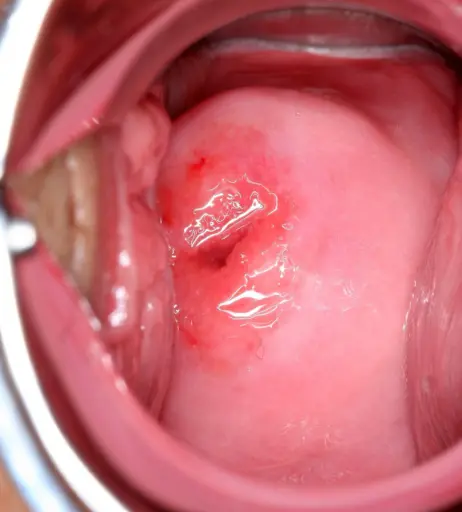 Image 10801615 from AIKA | あいか