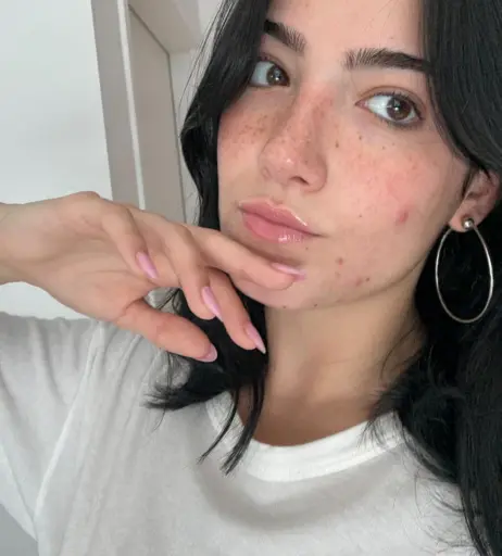 Image 10331256 from Charli D&#039;Amelio / Charli Damelio