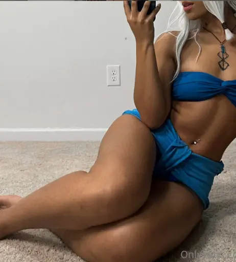 Image 10111856 from Frizzylifts | Missfrizz