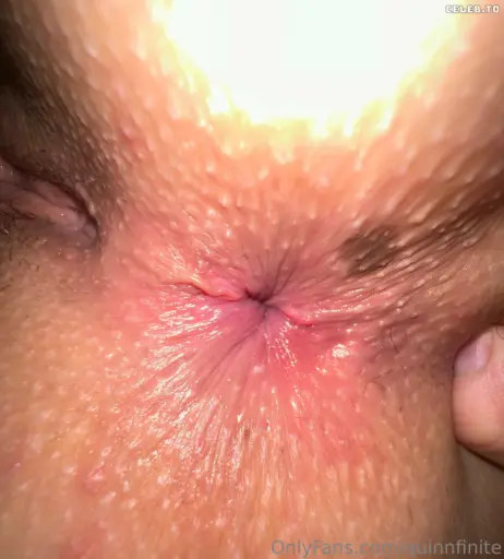 Image 3139217 from Quinn Finite