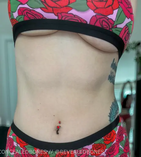 Image 3650972 from ConcealedBones