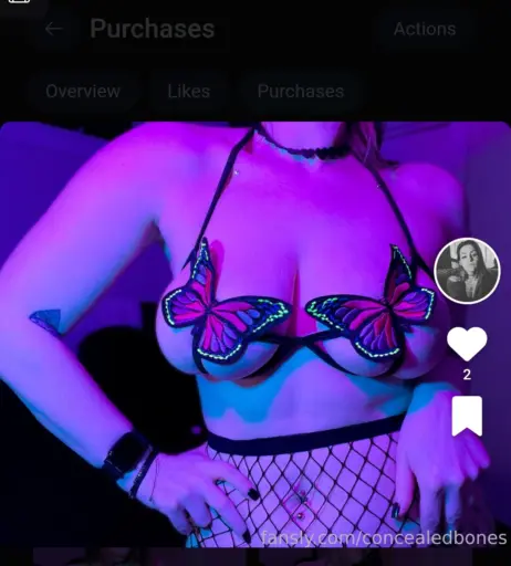 Image 3646356 from ConcealedBones