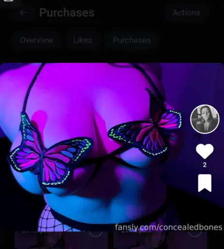 Image 3646309 from ConcealedBones