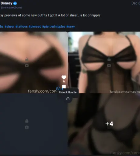 Image 4358935 from ConcealedBones