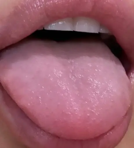 Image 4860477 from Artemida Rey