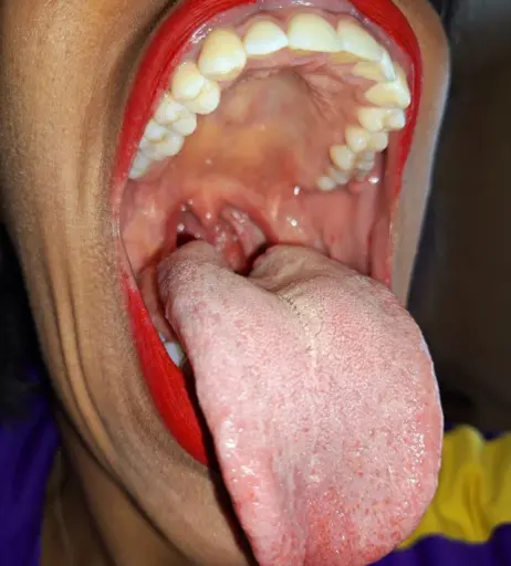 Image 4002888 from Goldenlace