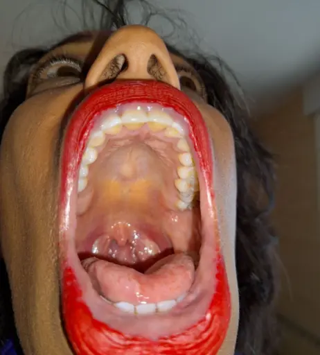 Image 4002844 from Goldenlace