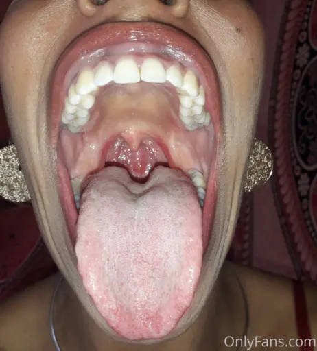 Image 4003432 from Goldenlace