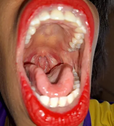 Image 4003149 from Goldenlace