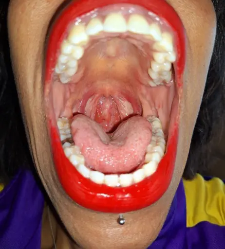 Image 4003160 from Goldenlace