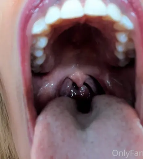 Image 4003208 from Goldenlace